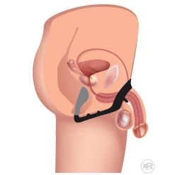 Vendor-unknown Excursion Silicone Triple Stim Anal Plug With Cock And Ball Ring New Items